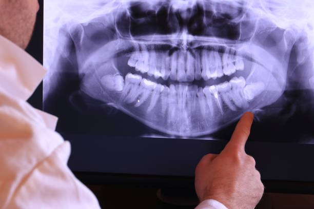 Best Emergency Root Canal Treatment in Hallsville, MO